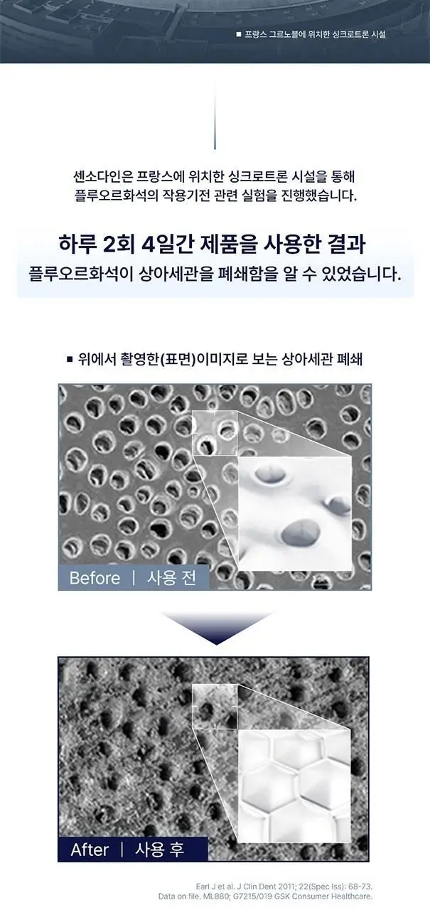 [불소 포함] 센소다인 치약 6종 택1 상세페이지 5